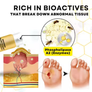 BeeVenom Diabetic Foot Treatment Spray