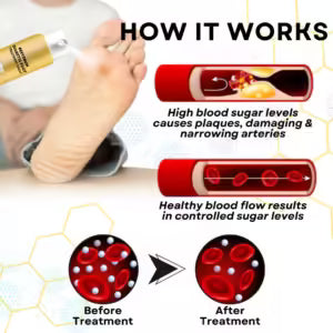 BeeVenom Diabetic Foot Treatment Spray