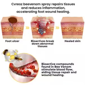 BeeVenom Diabetic Foot Treatment Spray